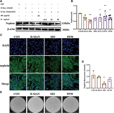 Piperazine ferulate inhibits diabetic nephropathy by suppressing AGE/RAGE-mediated inflammatory signaling in rats and podocytes
